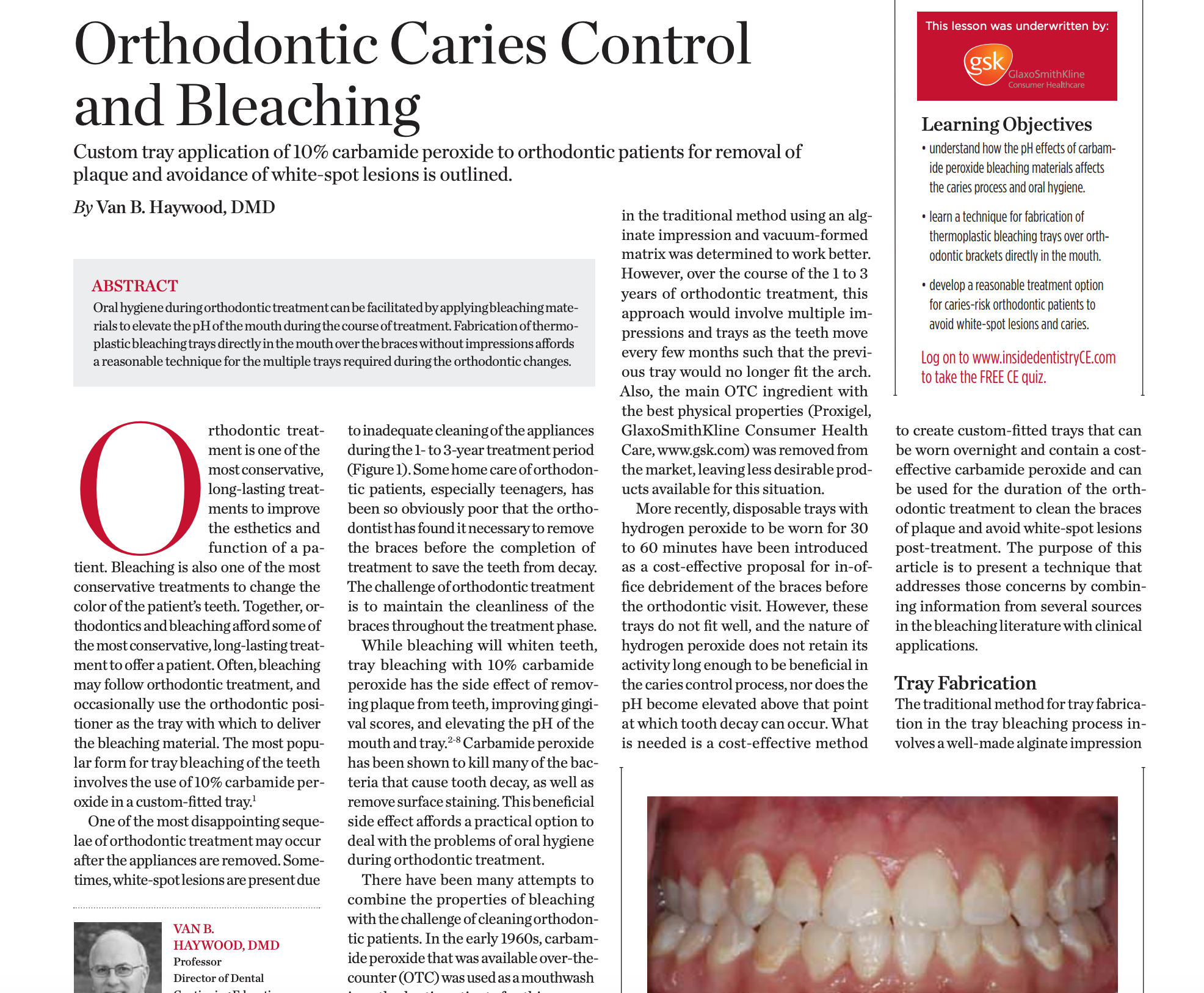Orthodontic Caries Control and Bleaching